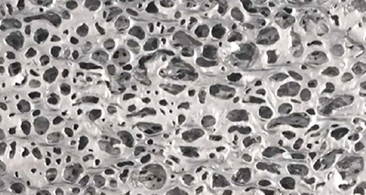 Alusion mittlere Zellgröße